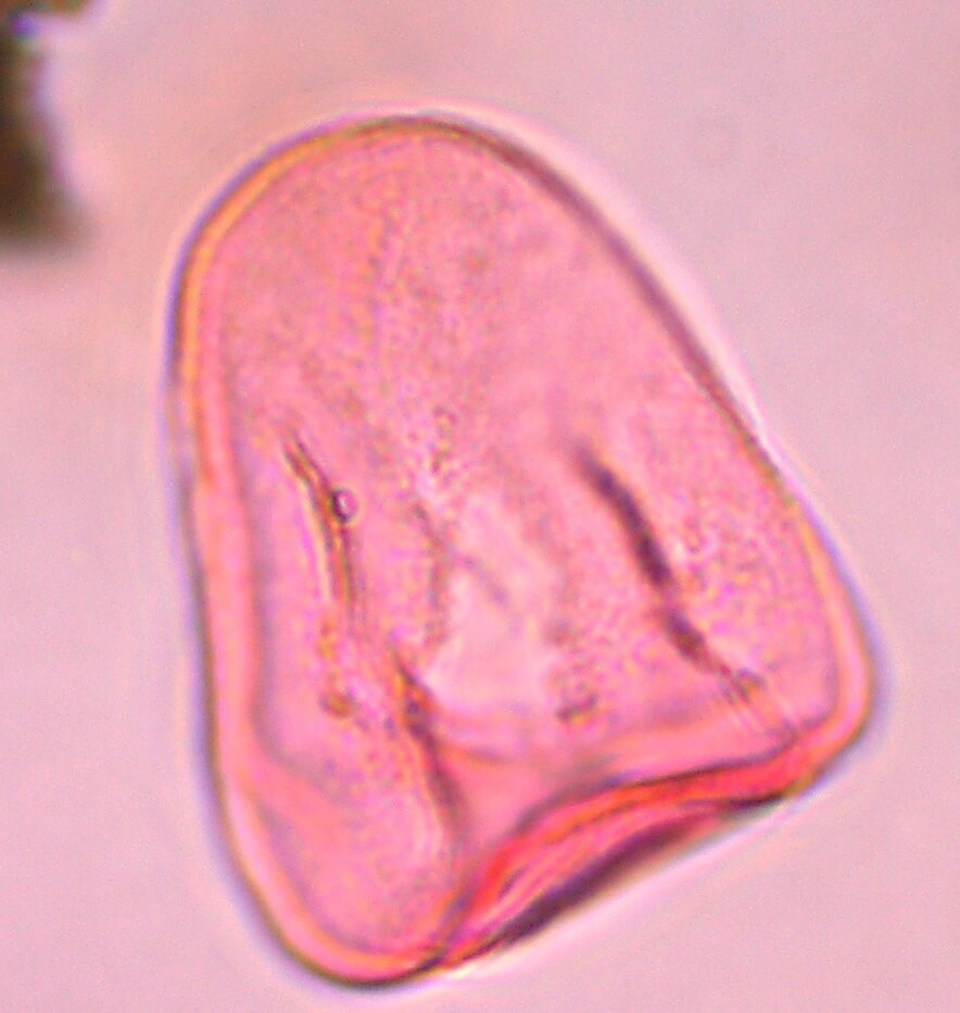 Cyperaceae (sedges) pollen under the microscope (credit: Andri van Aardt) Cyperaceae (sedges) pollen under the microscope (credit: Andri van Aardt)